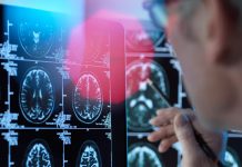 Studiul dezvaluie modul in care motoarele de cautare de pe internet ne afecteaza memoria