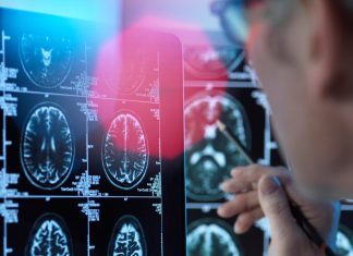 Studiul dezvaluie modul in care motoarele de cautare de pe internet ne afecteaza memoria